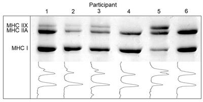 Skeletal muscle fibre type and enzymatic activity in adult offspring following placental and peripheral malaria exposure in foetal life